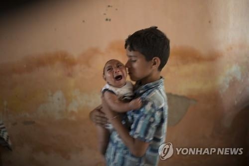 카니발 시즌 앞둔 브라질…"축제 기간 소두증 대확산 우려" - 3