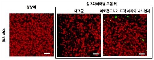 "나노입자 항산화제, 생쥐 알츠하이머 치료 효과" - 3