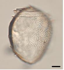 디노피시스 엘롱가타(Dinophysis elongata)