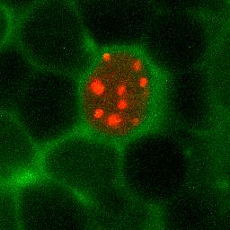 신경세포 활동성(녹색)과 염색체 활동성(빨간색) 영상