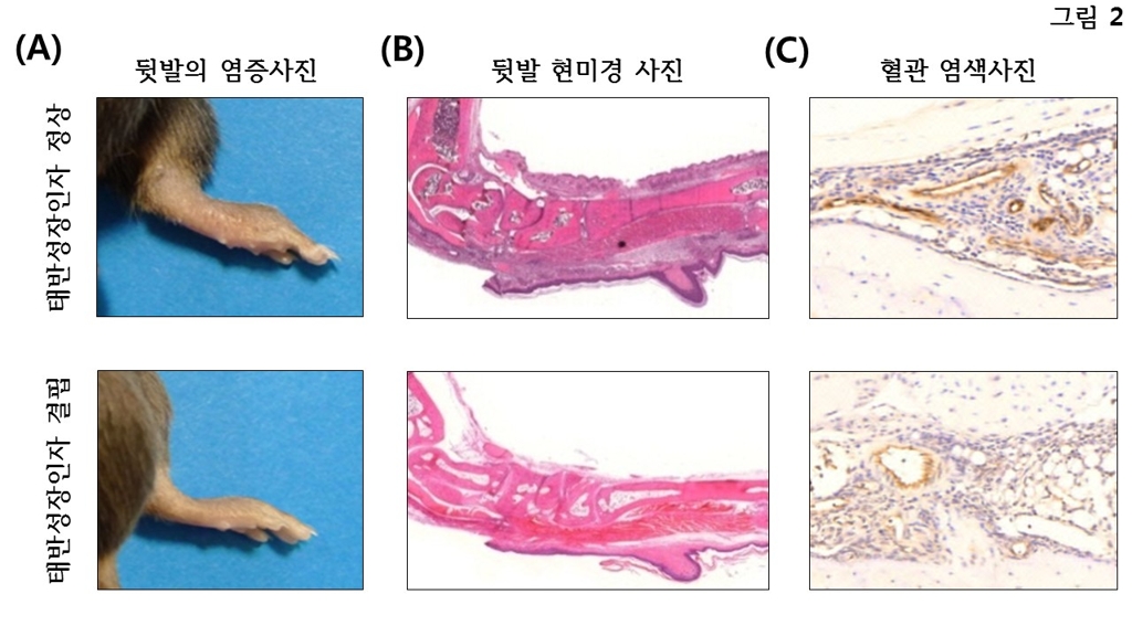 태반성장인자에 따른 염증 반응 결과