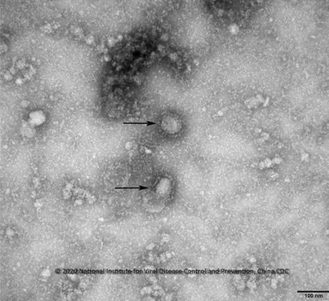 전자현미경을 통해 본 중국 우한 폐렴의 원인인 신종 코로나바이러스