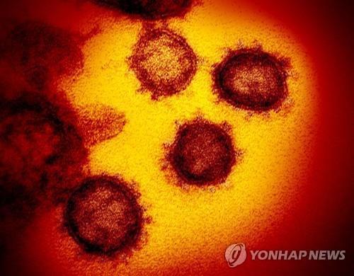 전자 현미경으로 찍은 신종 코로나바이러스