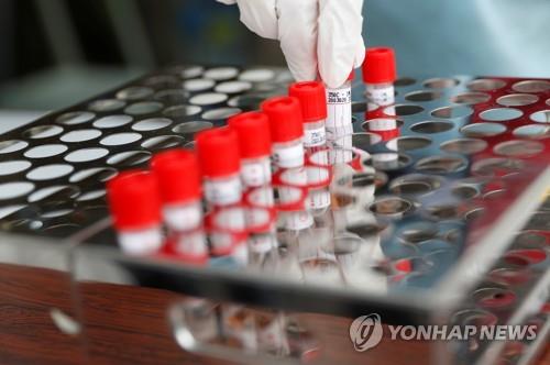 도쿄에 드라이브 스루 PCR 검사 도입
