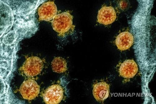 신종 코로나바이러스를 전자 현미경으로 촬영한 이미지. [AP=연합뉴스 자료사진]