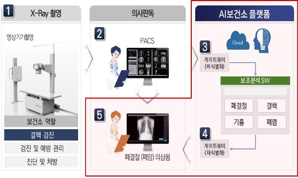 AI 보건소 모식도