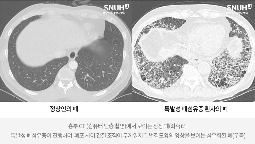 [분당서울대병원 제공]
