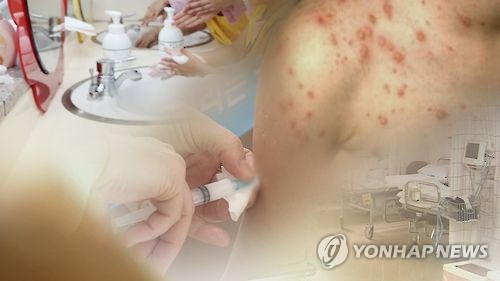 수두·유행성이하선염 감염 주의(CG)