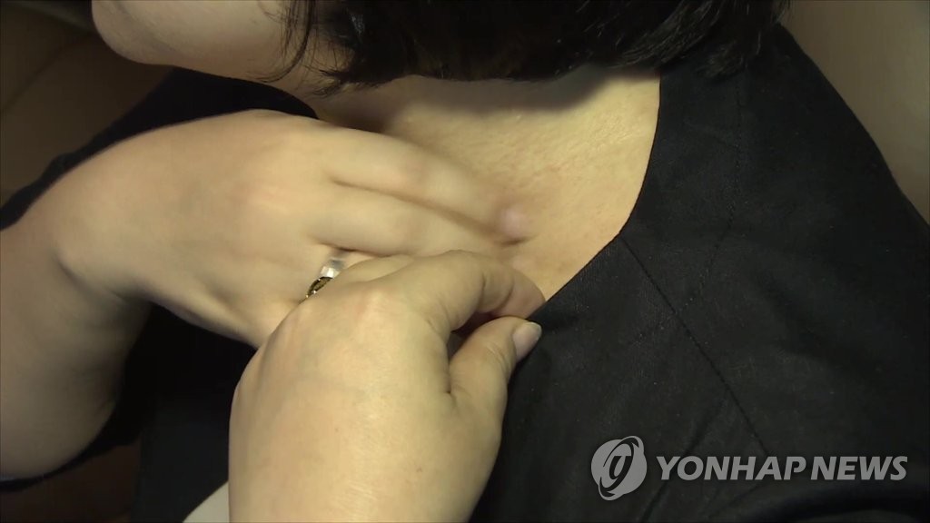 가려움증