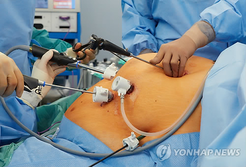 독일 고도비만 수술