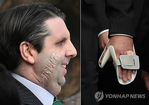 피습의 흔적