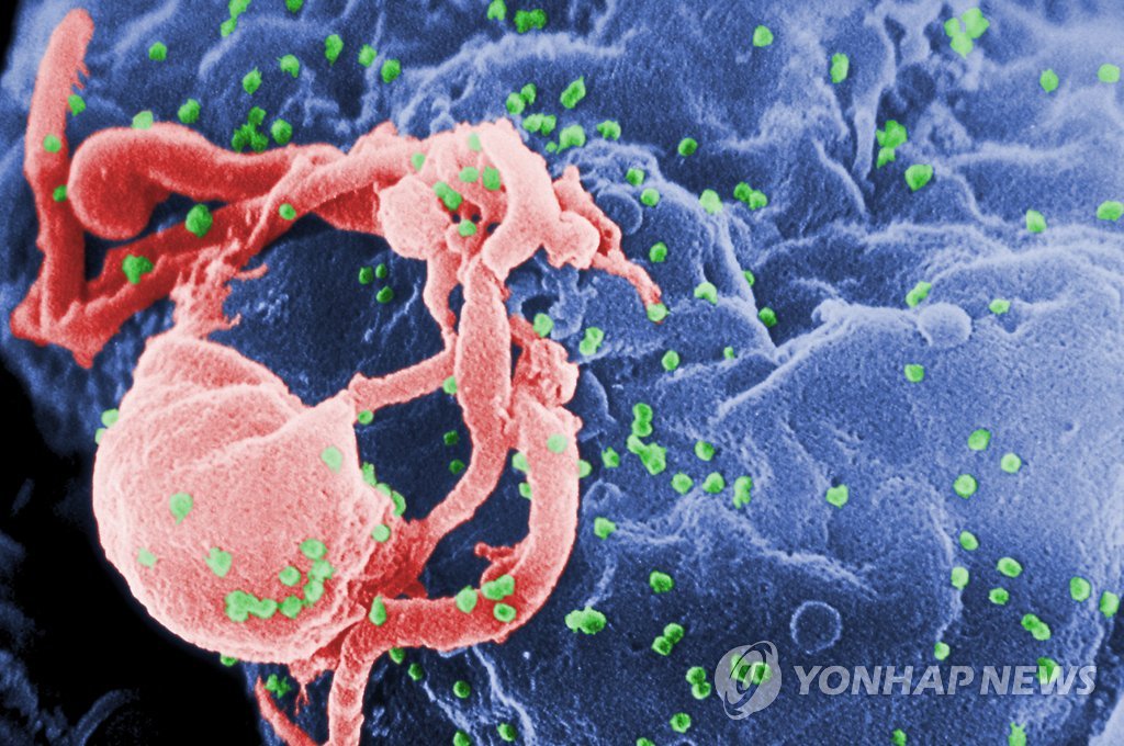 에이즈(AIDS)의 원인이 되는 인간면역결핍바이러스(HIV)