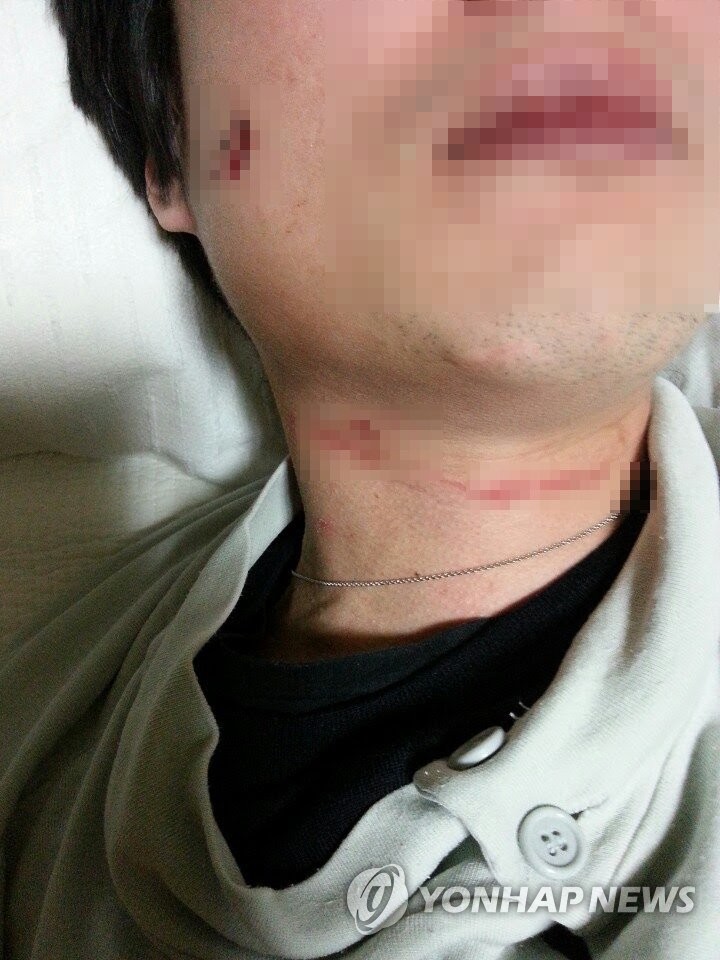 조현아 남편이 공개한 폭행 흔적