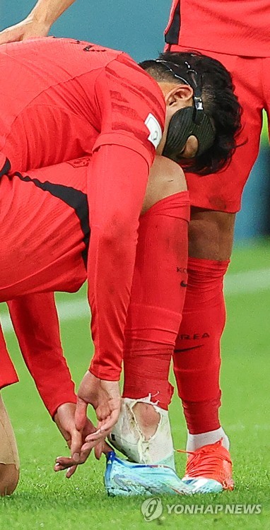 손흥민 찢어진 양말 투혼