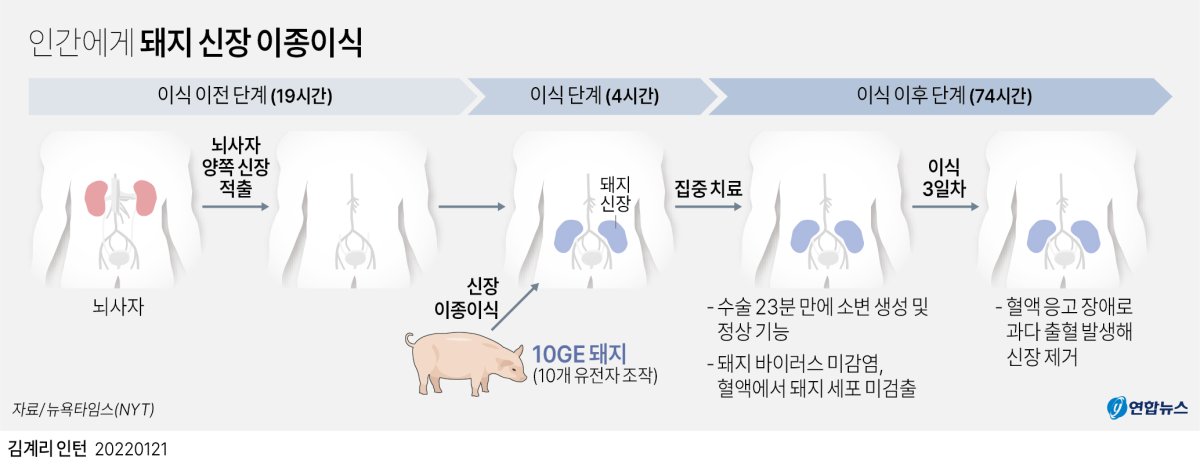  인간에게 돼지 신장 이종이식