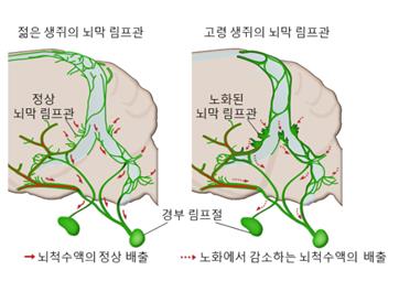 노화에 따라 뇌막 림프관이 비대해짐을 나타낸 그림 