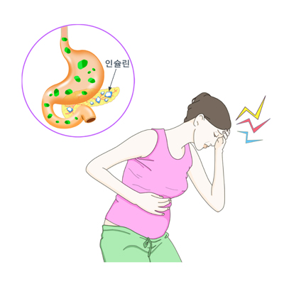 임신성 당뇨