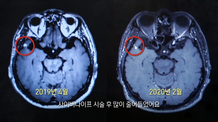 생로병사의 비밀