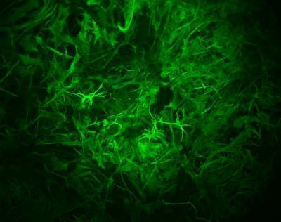 장기기억 형성에 관여하는 성상교세포(녹색)