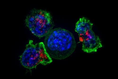 암세포(청색)를 둘러싸고 있는 킬러 T세포(녹색·적색) 