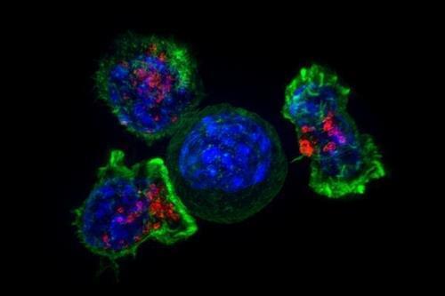 암세포(청색)를 둘러싸고 공격하는 킬러 T세포(녹색ㆍ적색)