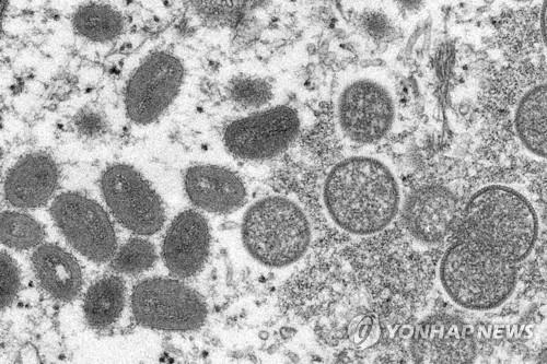 원숭이두창 바이러스(왼쪽 타원형)에 감염된 사람 피부 샘플의 전자현미경 이미지. 
