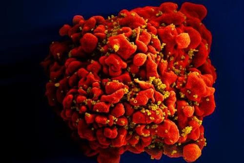 HIV에 감염된 면역세포