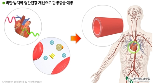 "당뇨병에 운동은 필수…심근경색·뇌졸중 위험 34% 낮춘다"