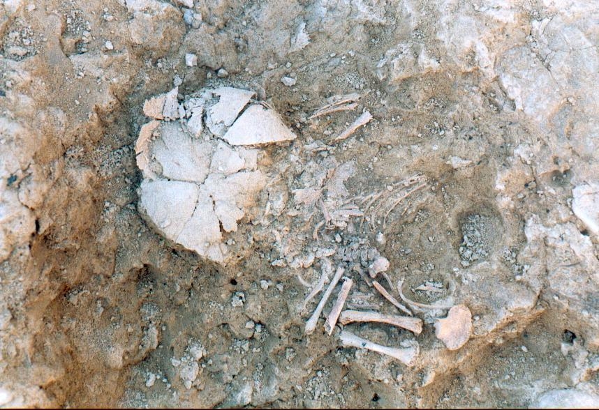 스페인 라스 에레타스 철기시대 유적에서 발굴된 다운증후군 태아 유골