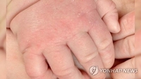 말레이서 심장마비로 숨진 아빠 팔에 깔려 3개월 아기도 사망