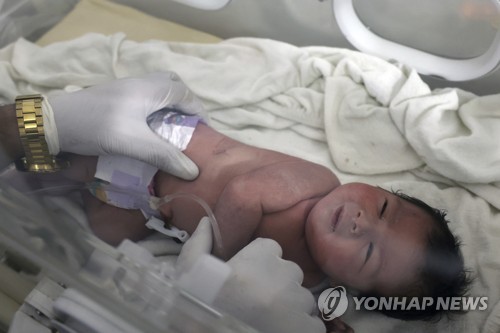 시리아 지진 피해 현장에서 구조된 신생아